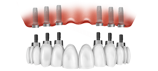 https://wellcaresolutions.al/grc/wp-content/uploads/2024/05/allon6.png