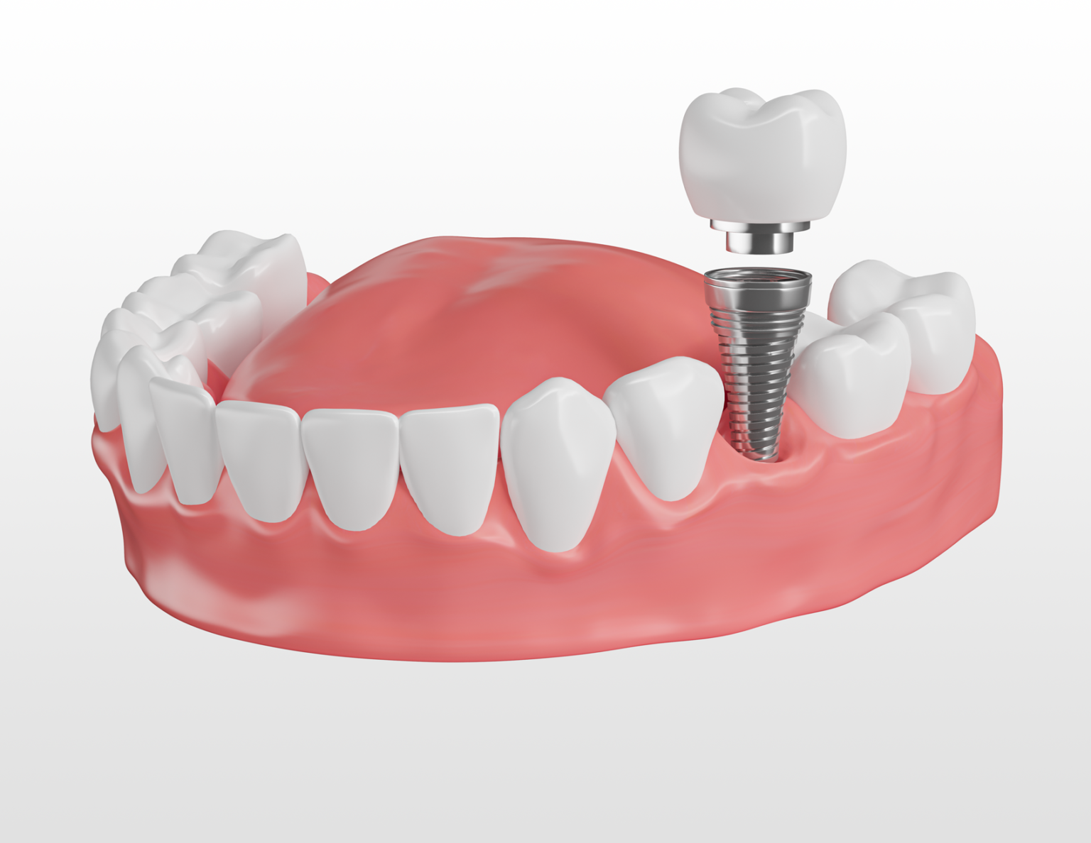 https://wellcaresolutions.al/wp-content/uploads/2024/05/Artboard-1-5-1536x1188-1.png